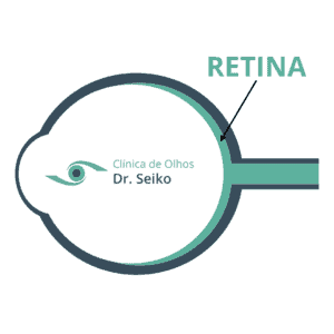 Imagem da Retina - Clínica Dr. Seiko